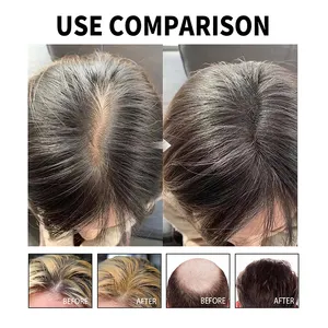 100 % natürliches Eigenmarken-Haarwachstumsöl Serum Rosemary Mint Kopfhautstärkung Rosemaryöl Haarwachstum