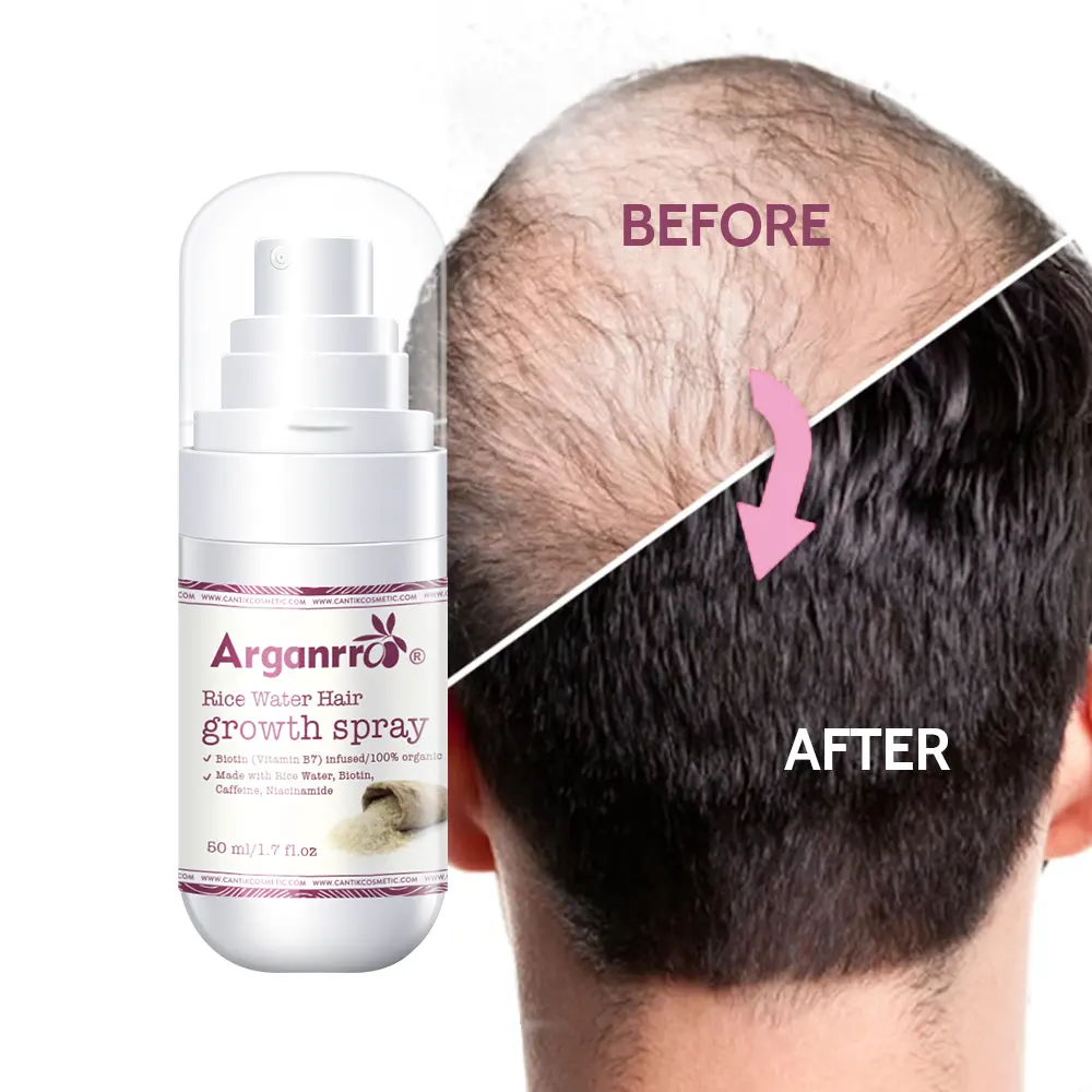 Sérum de croissance de cheveux humains biotine pour hommes, pour la croissance des cheveux, l'amincissement des cheveux et la calvitie