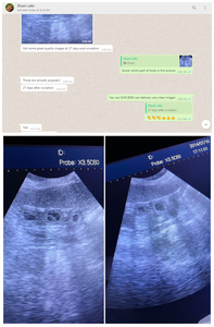 Tablette médicale échographie équipement obstétrique échographes médical portable machine à ultrasons - Product Image 3
