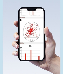 Raqueta de Tenis de Mesa Inteligente con Datos Visuales, <span class=keywords><strong>iBat</strong></span> 1 Inteligente, Artículos Deportivos Inteligentes - Product Image 5