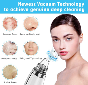 USB-C Vacuum Blackhead Remover Handheld Electric Suction Facial Nose <b>Pore</b> <b>Cleaner</b> for Home Use - Product Image 3