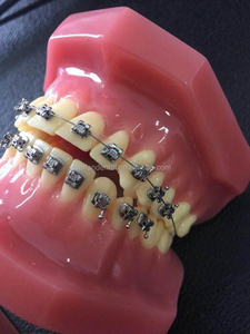 [Aifan Dental ] <span class=keywords><strong>MIM</strong></span> <span class=keywords><strong>Ortho</strong></span> staffe metalliche sabbiate monoblocco OC ROTH 022 HK 3s 4s 5s staffe <span class=keywords><strong>Ortho</strong></span> classiche - Product Image 4