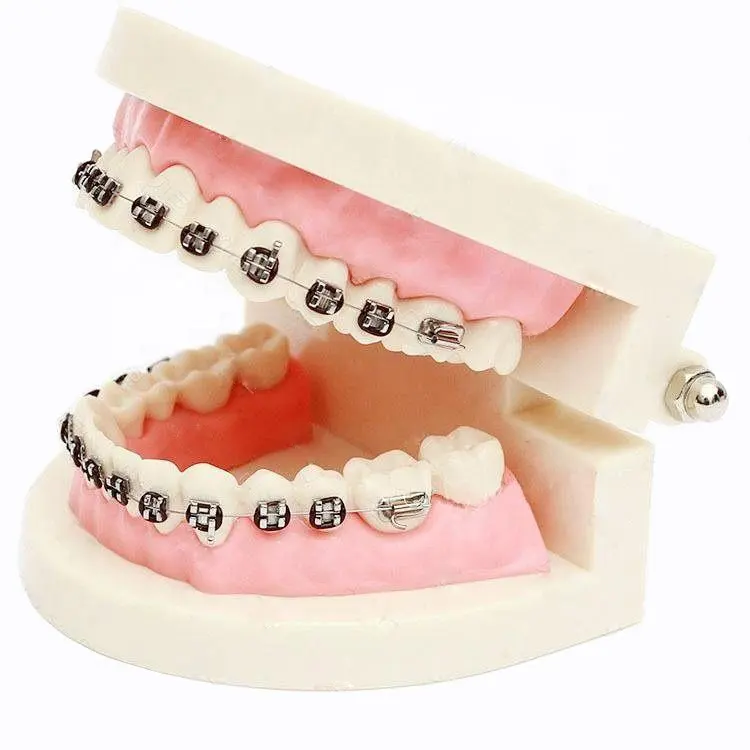 Tiantian metal ROTH Edgewise M歯ブラケット歯科技工所材料義歯