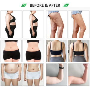 Nouvelle technologie de raffermissement cutané en plastique, machine de réduction de la cellulite 10D, appareil de remodelage corporel, thérapie de perte de poids indolore - Product Image 6
