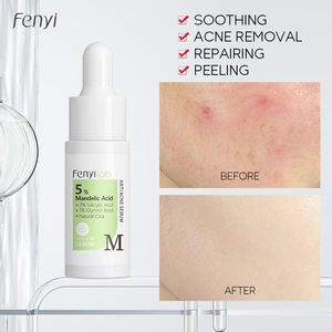 Atacado 5% Mandelic Acid Anti Acne Soro Calmante Remover Marcas de Acne Vermelhidão Shrink Poros 17ml Face Care Serum - Product Image 5