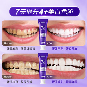 Lvspv Whitening Toothpaste 100g Triple Brightening Cold <b>Light</b> Teeth Care Oral Hygiene For <b>Fresh</b> Breath - Product Image 2
