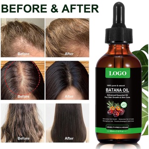 Aceite de Batana 100% Puro, Natural y Orgánico, Aceite Esencial Avanzado para el Crecimiento del Cabello y Cuidado de la Piel - Product Image 6