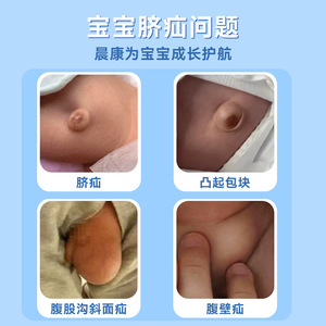 Chenkang Acupressure Stimulation Patch 5cmx5cm <b>White</b> For Infant Umbilical Hernia Treatment - Product Image 5