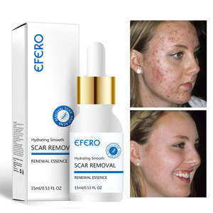 EFERO Scar Serum Skin Lightening Oil Hyaluronic Acid Serum Removal Acne Scar Whitening Spots <strong>Liquid</strong> <strong>Vitamin</strong> <strong>E</strong> Niacinamide Female - Product Image 4