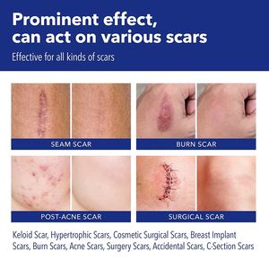 แผ่นซิลิโคนสำหรับผ่าตัดรักษาสิวเกรดทางการแพทย์นำกลับมาใช้ใหม่ได้ฉลากส่วนตัวของแลนซ์ - Product Image 4