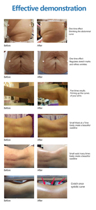 Appareil Ultra Sans Contact pour Amincissement du Ventre, des Bras et des Cuisses, Réduction de la Graisse Non Invasive, Équipement de Réduction de la Circonférence pour la Beauté - Product Image 6