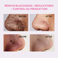 Kit de bandes nasales anti-points noirs OEM personnalisé en 3 étapes pour déboucher les pores, resserrer les pores et apaiser en douceur le visage – Soin de la peau