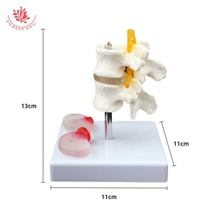 Modèle de lésion de la colonne vertébrale lombaire FRT038 modèle de pathologie vertébrale à deux segments du disque lombaire enseignement des étudiants en médecine - Product Image 2