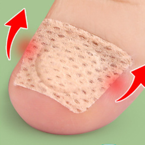 Nagelpflege-Pflaster für eingewachsene Zehennägel, Nagelhautpflege, orthopädisches weiches Nagelpflaster zur Reparatur von Onychomykose, Xiaoyuan JH058 - Product Image 2