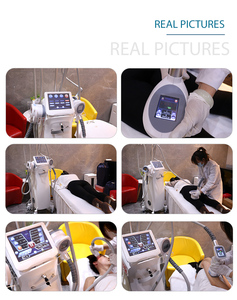 Máquina de Cavitación al Vacío para Moldear el Cuerpo 2026, Cepillo Limpiador Facial, Rodillo de Vacío para Quemar Grasa, Equipo de Belleza - Product Image 4