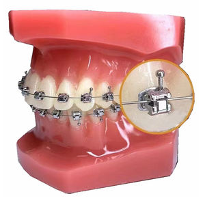<span class=keywords><strong>2026</strong></span> Neue Chinesische Produkte Changsha Dental Selbstligierende Brackets Kieferorthopädische Zahnspangen Original Zahnspangen Modisch - Product Image 1