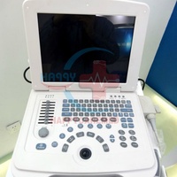 Échographe médical numérique complet pour ordinateur portable HC-A003, sonde convexe humaine, appareil d'échographie