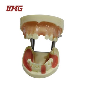 Modelo de Práctica de Implantes Dentales UMG UM-2003 con Encía Suave para Prácticas de Corte, Sutura e Implantes, Certificado CE - Product Image 1