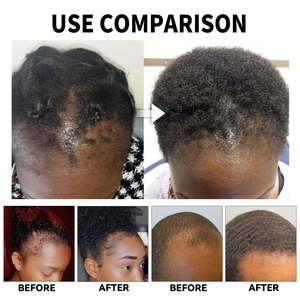 OEM organique renforcement réparation poils incarnés sérum extrait croissance des <span class=keywords><strong>cheveux</strong></span> huile bouteilles pour femmes noires ordinaire - Product Image 3