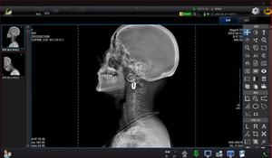 عرض خاص 17*17 بوصة الطبية الرقمية الدكتور لوحة السلكية 1717 مكشاف ألواح مسطحة - Product Image 6