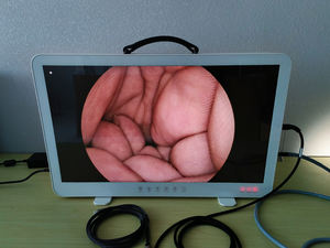 Portátil 22 polegada 24 polegada 27 polegada 32 polegada Laparoscopia Médica Ginecologia Urologia ENT Ortopedia HD Endoscópio Câmera - Product Image 6