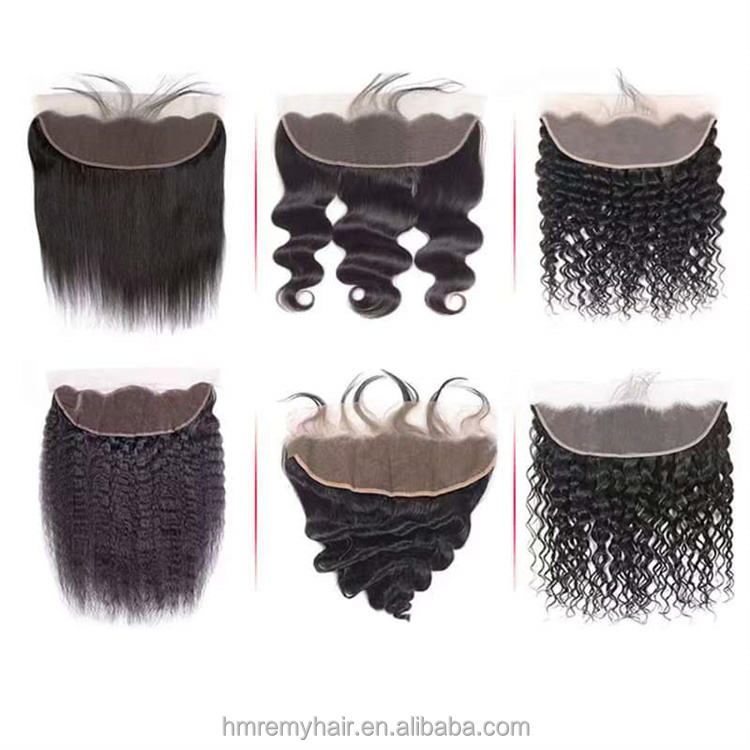 หน้าผาก