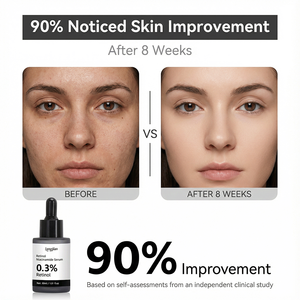 เซรั่มเรตินอล ผิวเรียบเนียน 0.3% เรตินอล 5% ไนอะซินาไมด์ 20+ ส่วนผสมปลอบประโลมผิว อ่อนโยนสำหรับผิว<span class=keywords><strong>เริ่ม</strong></span><span class=keywords><strong>ต้น</strong></span> ใช้ได้กับผิวที่มีริ้วรอยและต่อต้านริ้วรอย - Product Image 5