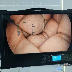 Günstiger Preis All-in-One-Videokamera für die medizinische Diagnose Ohrnasen-und Hals-und Laparoskopie-Endoskopie kamera - Product Image 1