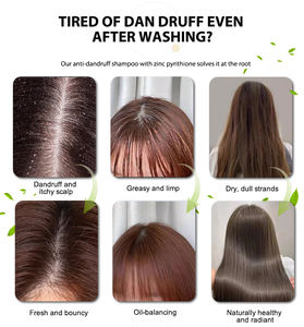 Prodotti per la Cura dei Capelli Succsion Gel all'Olio di Cocco Nutriente Rinfrescante Idratante Antiforfora Biologico - Product Image 6