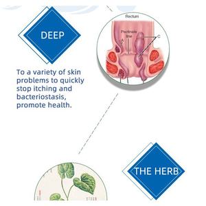 Мазь от геморроя, анальная трещина, Внутренние Внешние стопки, анальная трещина, обезболивающий Китайский травяной крем 20 г - Product Image 3