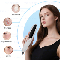 Portable 308nm UVB Photothérapie Excimer Laser Vitiligo Psoriasis Crème Traitement Lampe Uv Photothérapie Luminothérapie Machine