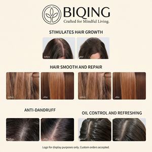 Champú y Acondicionador OEM Anticaspa con Cebolla, Biotina y Romero - Volumen desde la Raíz, Champú para <span class=keywords><strong>el</strong></span> Cuidado del <span class=keywords><strong>Cabello</strong></span> con Aceites Esenciales Frescos para <span class=keywords><strong>el</strong></span> Crecimiento del <span class=keywords><strong>Cabello</strong></span> - Product Image 5