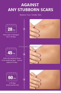EKBER Crema Riparatrice Naturale Vegana per Danni Cutanei, Rimozione Cicatrici da Acne, Etichetta Privata - Product Image 6