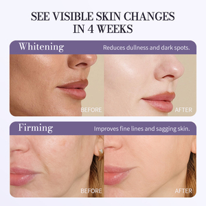 Ensemble de soins de la peau anti-âge en marque privée, 4 pièces, nettoyant <span class=keywords><strong>visage</strong></span>, sérum, crème, tonique, anti-acné, blanchissant, <span class=keywords><strong>kit</strong></span> de soins <span class=keywords><strong>du</strong></span> <span class=keywords><strong>visage</strong></span> pour femmes - Product Image 4
