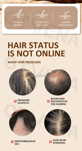 OTVENA Huile Capillaire Naturelle Anti-Chute Fortifiante et Lissante pour Cheveux Secs, Favorisant <span class=keywords><strong>la</strong></span> Croissance, Marque Privée, Vente en Gros - Product Image 5