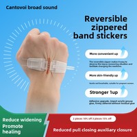 Réducteur de tension de plaie de pansement cutané Patch de cicatrice médicale Bandes steri Sangle élastique Type de fermeture éclair Bande de réduction de cicatrice sans couture
