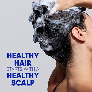 Shampoo antipelliculaire Butterfly pour hommes et femmes, pour cuir chevelu sec, pellicules, démangeaisons et excès de sébum - Nourrit le cuir chevelu, réduit la casse des cheveux et les pellicules - Product Image 2