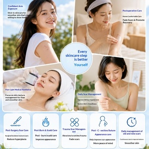 เจลซิลิโคนทางการแพทย์สำหรับรักษา<span class=keywords><strong>แผล</strong></span> ลดรอยแผลเป็น ลดรอยแผลเป็นแบบไฮเปอร์พลัสติก สำหรับรอยแผลเป็นบริเวณมือ สีฟ้าขาว ผลิตในจีน - Product Image 4