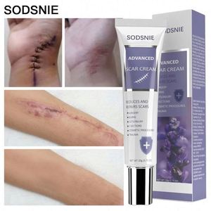 Soins de la peau du corps et du visage, élimine les cicatrices de grossesse, l'acné, les brûlures chirurgicales, crème d'élimination des cicatrices - Product Image 4