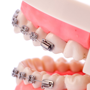 Brackets falsos para los dientes fáciles de colocar - Product Image 5