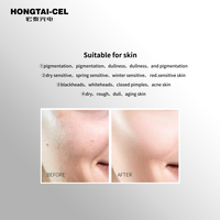 Outil non invasif à double technologie : Jet Peel haute pression pour le lifting et le rajeunissement par gouttelettes d'eau en salon