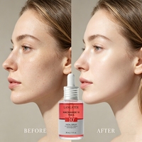 Sérum éclaircissant et régulateur de sébum à la Niacinamide, Acide Tranexamique, Acide Azélaïque et Acide Hyaluronique