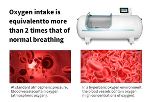 Suyzeko Professional 2.0 ATA Sitting Type Hard <strong>Hyperbaric</strong> Oxygen <strong>Chamber</strong> for Athletes - Product Image 5