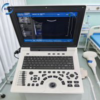 Appareil d'échographie portable noir et blanc avec écran de 12,1 pouces, scanner d'échographie numérique 2D pour hôpital et clinique
