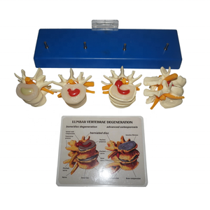 R020704 אדם עמוד השדרה המותני מודל שלד האנטומיה רפואית - Product Image 2