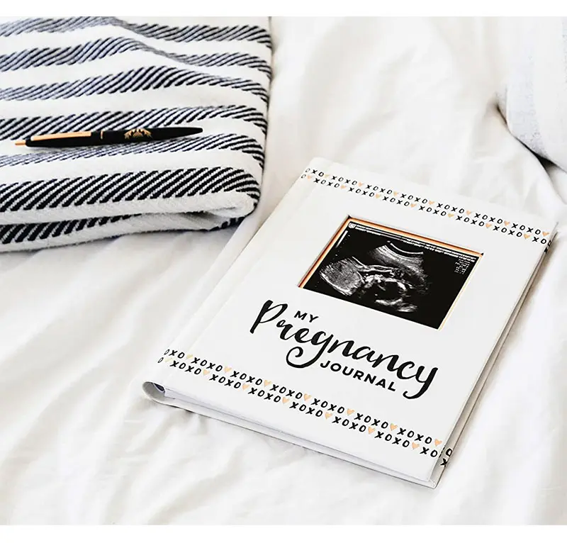 Livro da memória do livro da gravidez do bebê personalizado da fábrica da china do diário da gravidez para a nova mãe