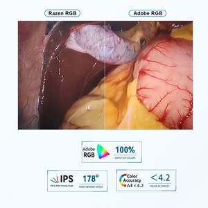 Equipo de Diagnóstico Veterinario Todo en Uno con Endoscopia FHD de Fábrica OEM/ODM para Veterinarios y Cirugía Veterinaria Endoscópica - Product Image 4