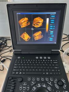 Mesin Doppler <span class=keywords><strong>Ultrasound</strong></span> elektrik hitam 12 inci, peralatan diagnostik dokter hewan, peralatan perangkat medis logam - Product Image 5
