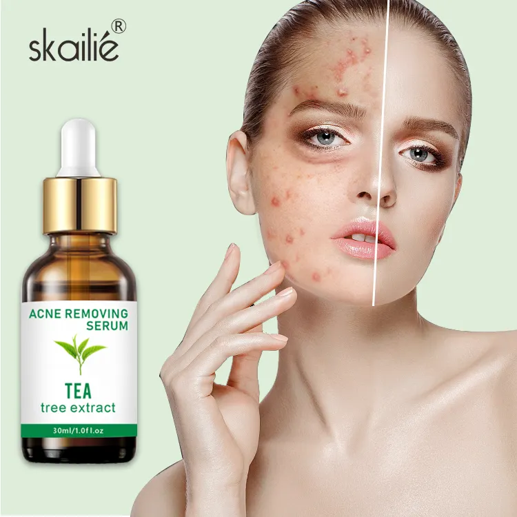 Marque privée Acide salicylique naturel végan biologique Essence d'arbre à thé traitement de l'acné apaisant élimination de l'acné pour le visage