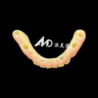 Prothèse dentaire implantée avec piliers en titane et couronne en zircone, fabrication sur mesure CAD/CAM pour cliniques et laboratoires dentaires